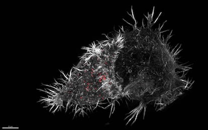 Estructura en 3D que muestra cómo una célula NK (por las siglas en inglés de 'natural killer'), a la izquierda, ataca a otra célula, a la derecha, de forma más redondeada. Las células NK son fundamentales en el sistema inmune de los mamíferos, pues pueden reconocer y destruir células infectadas. La imagen fue tomada con un microscopio de alta resolución. Los premios Wellcome Awards, que se celebraron por primera vez en 1997, premian el sentido artístico de las fotografías y las ilustraciones, pero también las técnicas con las que han sido elaboradas.