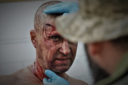 A soldier is treated in a field hospital near the Zaporizhzhia front, in southern Ukraine.