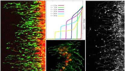 Diversas imágenes de tejidos en desarrollo de la mosca de la fruta o mosca del vinagre ('Drosophila melanogaster'), en las que se observan las extensiones celulares (filopodios). La gráfica muestra la simulación matemática de información transportada en el proceso de comunicación (densidad de Sonic Hedgehog).