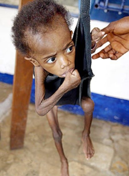 Un niño liberiano con una grave malnutrición es pesado en un centro de Acción contra el Hambre en Monrovia.