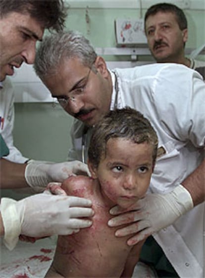 Los médicos atienden a un niño palestino herido en el hospital de Gaza.
