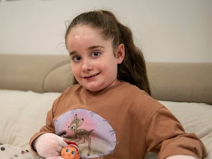 Mía Millán en su casa de Linares. Una nueva terapia aprobada por la EMA para los niños con piel de mariposa, una grave enfermedad genética.