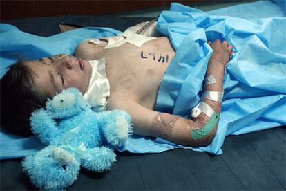 Un niño iraquí se recupera en un hospital de Mosul, tras resultar herido en el atentado cometido en Tel Afar.
