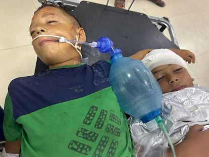 Abdullah, de 8 años (a la izquierda), y Hazwan, de 6 años (a la derecha), primos hermanos y ambos en coma después de un bombardeo israelí. Esquirlas de metralla fracturaron sus cráneos y se impactaron en sus cerebros, provocándoles hemorragias internas, más graves en el caso de Abdullah, cuyo cuadro fue catalogado como “hopeless case”. Ambos fueron bombardeados en la zona humanitaria de Al Mawasi, la zona que el ejército israelí ha indicado a la población que se dirija para no ser bombardeada. En el ataque, murieron varios miembros de su familia. (Jan Yunis, 11 de julio de
2025).