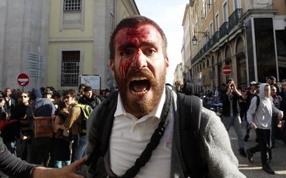Un manifestante, con la cara herida, tras la carga policial en Lisboa.