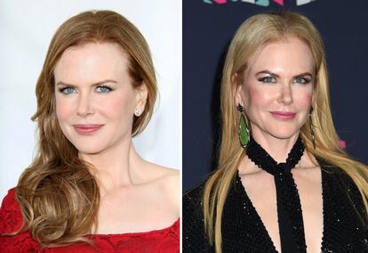 Nicole Kidman ha ido transformando su rostro con el paso de los años, cada vez con una cara más parecida a una muñeca de porcelana y con menos expresión. “Lo del bótox fue un error, fruto de la presión y del deseo de lucir mejor: algo que les pasa a muchas actrices en Hollywood. Puedo decir que no he vuelto a usarlo y que lo que ves ahora es fruto de una vida sana, de alejarme del humo del tabaco y de dormir todas las horas que puedo: nada de cirugía”, reconocía en una entrevista con EL PAÍS en 2014. En la imagen, en una fotografía tomada en 2011 y, a la derecha, la actriz en una alfombra roja el pasado junio.