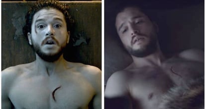 La herida de John Snow cambia misteriosamente.