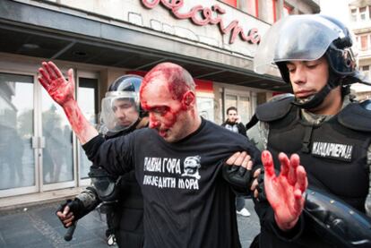 La policía detiene a un extremista herido durante los disturbios.