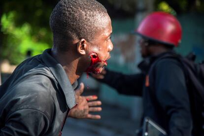 Un joven herido por un disparo de la policía pedía ayuda este martes, en Puerto Principe (Haití). Miles de manifestantes exigieron la renuncia del presidente del país, Jovenel Moise.