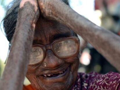 La lepra que no cesa