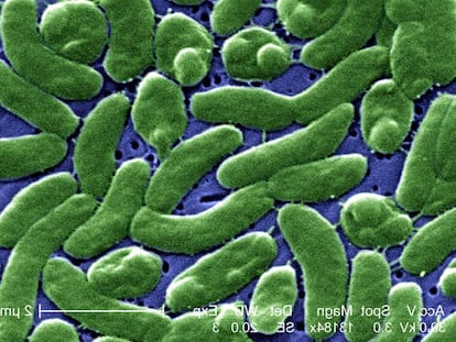 Colonia de &#039;V. vulnificus&#039; con la particular forma encorvada del g&eacute;nero &#039;vibrio&#039;