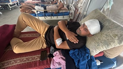 El periodista Hatem Omar, fotógrafo de Reuters, yace en una cama en el Complejo Médico Nasser, en Jan Yunis, en Gaza.