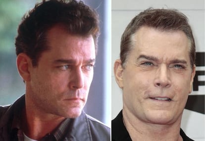 El actor estadounidense Ray Liotta solía tener una cara varonil, pero se ha inyectado tantas veces bótox que él mismo se ha convertido en su gran enemigo frente al espejo y ante las cámaras. Ahora ya no puede ni sonreír.