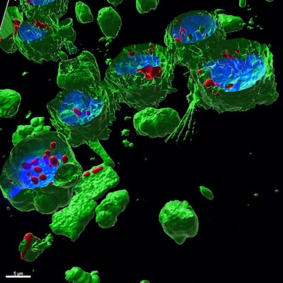 Estas son células en suspensión (monocitos THP-1) tratadas con nanoplásticos (PET). Para visualizar los diferentes compartimentos celulares, se han teñido con distintos fluorocromos: en verde se muestra la membrana celular teñida con CellMask, en azul el núcleo celular teñido con Hoechst, y en rojo los nanoplásticos teñidos con iDye Poly Pink (un colorante textil).
La imagen ha sido obtenida con un microscopio confocal de barrido láser, que emplea láseres de distintas longitudes de onda para excitar los fluorocromos y detectar su emisión. Concretamente, se trata de una representación 3D en la que se ha realizado un corte transversal para observar el interior de las células. En la imagen se aprecian los nanoplásticos (en rojo) dentro del citoplasma celular, muy cerca del núcleo (en azul), o incluso en contacto con él.