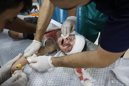 Médicos examinan a un niño herido en el hospital Mártir de Al-Aqsa en Deir al Balah, en la franja de Gaza, este sábado.