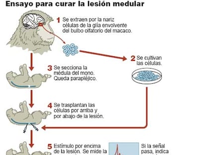 Esquema del ensayo para curar la lesión medular