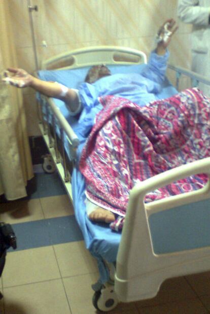 Abdu Moneim, tras autoinmolarse, en un hospital de El Cairo.