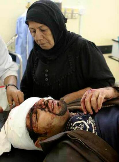 Un hombre herido en el atentado, en un hospital de Bagdad.