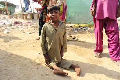 Un niño enfermo de poliomielitis en un suburbio de Karachi, Pakistán. 