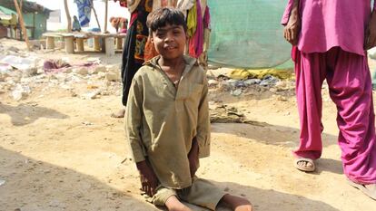 Un niño enfermo de poliomielitis en un suburbio de Karachi, Pakistán. 