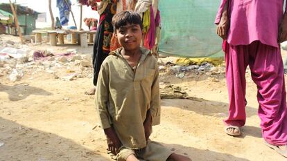 Un niño enfermo de poliomielitis en un suburbio de Karachi, Pakistán. 