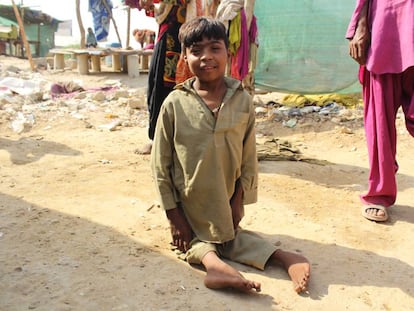 Un niño enfermo de poliomielitis en un suburbio de Karachi, Pakistán.
