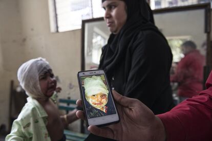 Un hombre musulmán muestra la foto que le tomaron a su hija nada más quemarse con agua hirviendo. Diez días después, la mejora salta a la vista, pero el dolor todavía es intenso. Jawahar no hace ninguna distinción entre sus beneficiarios, ni por religión, ni por tendencia política o casta.