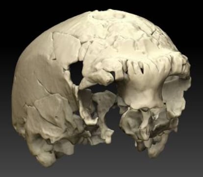 Reconstrucci&oacute;n del cr&aacute;neo en base a un esc&aacute;ner