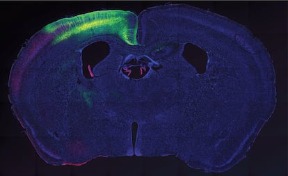 La imagen muestra una sección del cerebro de uno de los ratones del ensayo. En verde, la región del córtex activada por los ultrasonidos tras introducirle proteínas 'sonosensibles'.