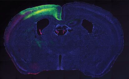 A section of the brain of one of the mice used in the study.