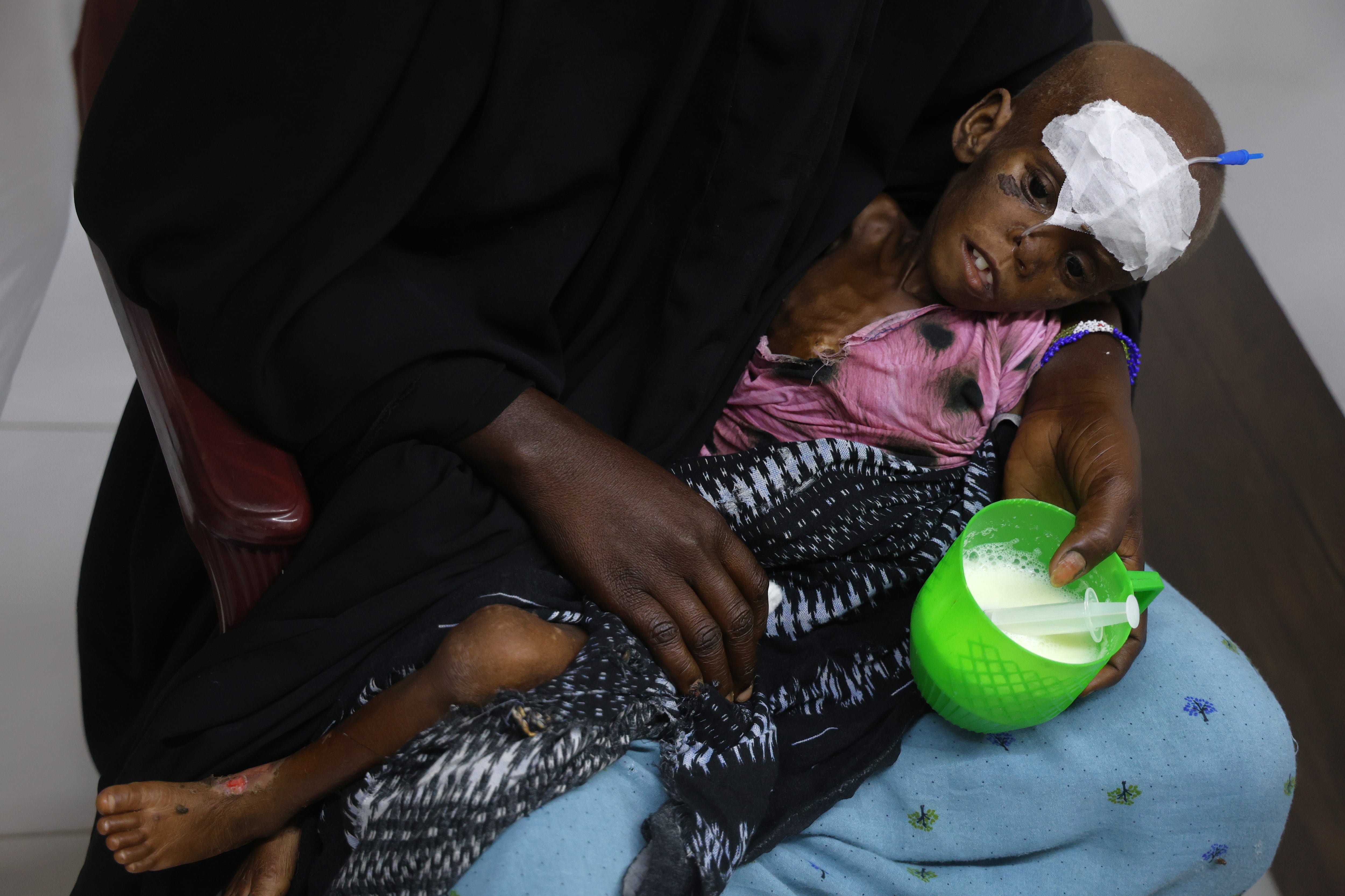 Somalia, the country that buries hungry babies: "We trust only God's help"