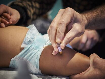 Un pediatra vacuna a un bebé en Francia.