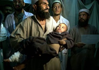 Un hombre lleva en brazos a su hijo de cuatro años para ser examinado en la sala de rayos X del hospital de Jalalabad. (AP)
