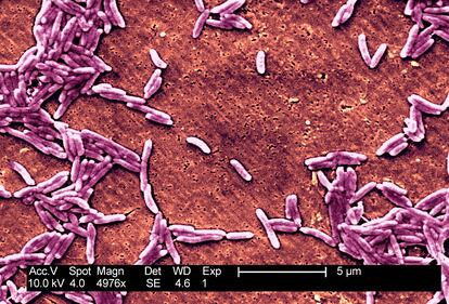 La bacteria Campylobacter.