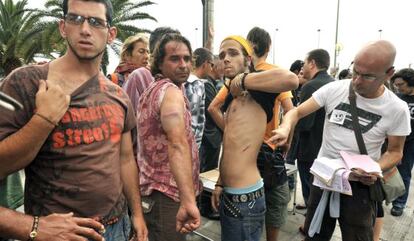 Varios manifestantes muestran los golpes sufridos al ser desalojados del parque San Telmo de Las Palmas de Gran Canaria.