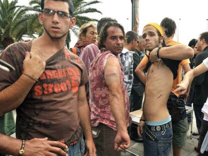 Varios manifestantes muestran los golpes sufridos al ser desalojados del parque San Telmo de Las Palmas de Gran Canaria.