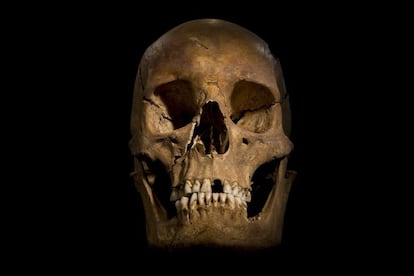 La calavera de Ricardo III. Los investigadores subrayaron el "excepcional estado de conservación" de los restos que encontraron.