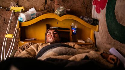 Belardino Quispe recostado en su cama debido a la herida de bala que sostuvo durante una protesta el 9 de enero.