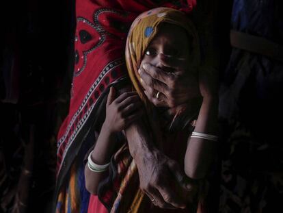 Una madre sostiene a su hija desnutrida, en Abyan, Yemen.