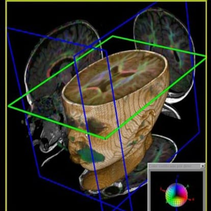 Reproducción de una resonancia magnética del cerebro de un bebé de 12 meses.