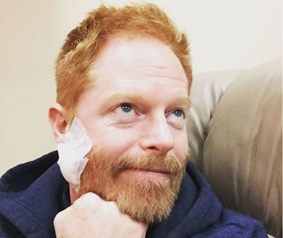 Jesse Tyler Ferguson tras su operación.