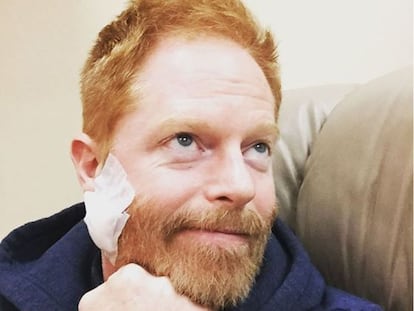 Jesse Tyler Ferguson tras su operación.