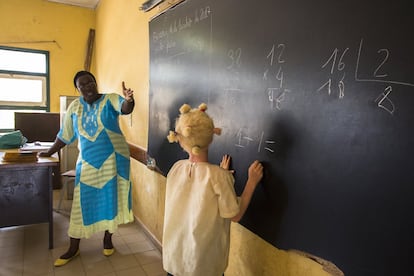 Aisha Darramé escucha atentamente la explicación de su maestra durante una clase. Aisha es albina y tiene una discapacidad visual, muy típica en personas con albinismo, por eso se sienta siempre en la primera fila de la clase. El albinismo está considerado como una discapacidad debido a los problemas de visión y de piel que tienen habitualmente las personas con albinismo.