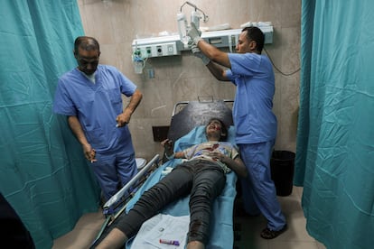 Una niña palestina, herida durante un ataque aéreo israelí, recibe tratamiento médico en el hospital de Al-Aqsa en Deir al Balah, en el centro de la franja de Gaza, este domingo.