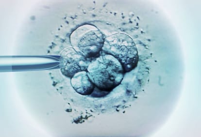 Fecundación in vitro.