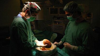 Miembros de la unidad de trasplantes del hospital sevillano Virgen del Rocío.