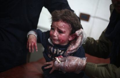 Un niño sirio herido en un ataque aéreo de las fuerzas leales al presidente Bachar el Asad es atendido en un hospital de campaña en la zona rebelde de Douma, al noreste de Damasco.