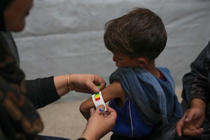 Una enfermera examina a un niño para detectar signos de desnutrición en una clínica médica en la ciudad de Gaza, el miércoles.