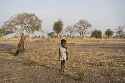 Un niño posa para una fotografía después de acabar el tratamiento incluido en un programa terapéutico, a las afueras de Udhaba, Sudán.