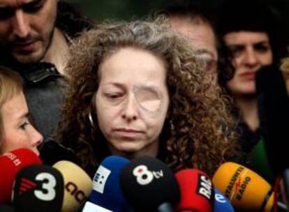 Ester Quintana, de 42 años, la mujer que perdió el ojo izquierdo a consecuencia de un fuerte impacto recibido en una calle de Barcelona durante las protestas registradas durante la huelga general del 14N. EFE/Archivo